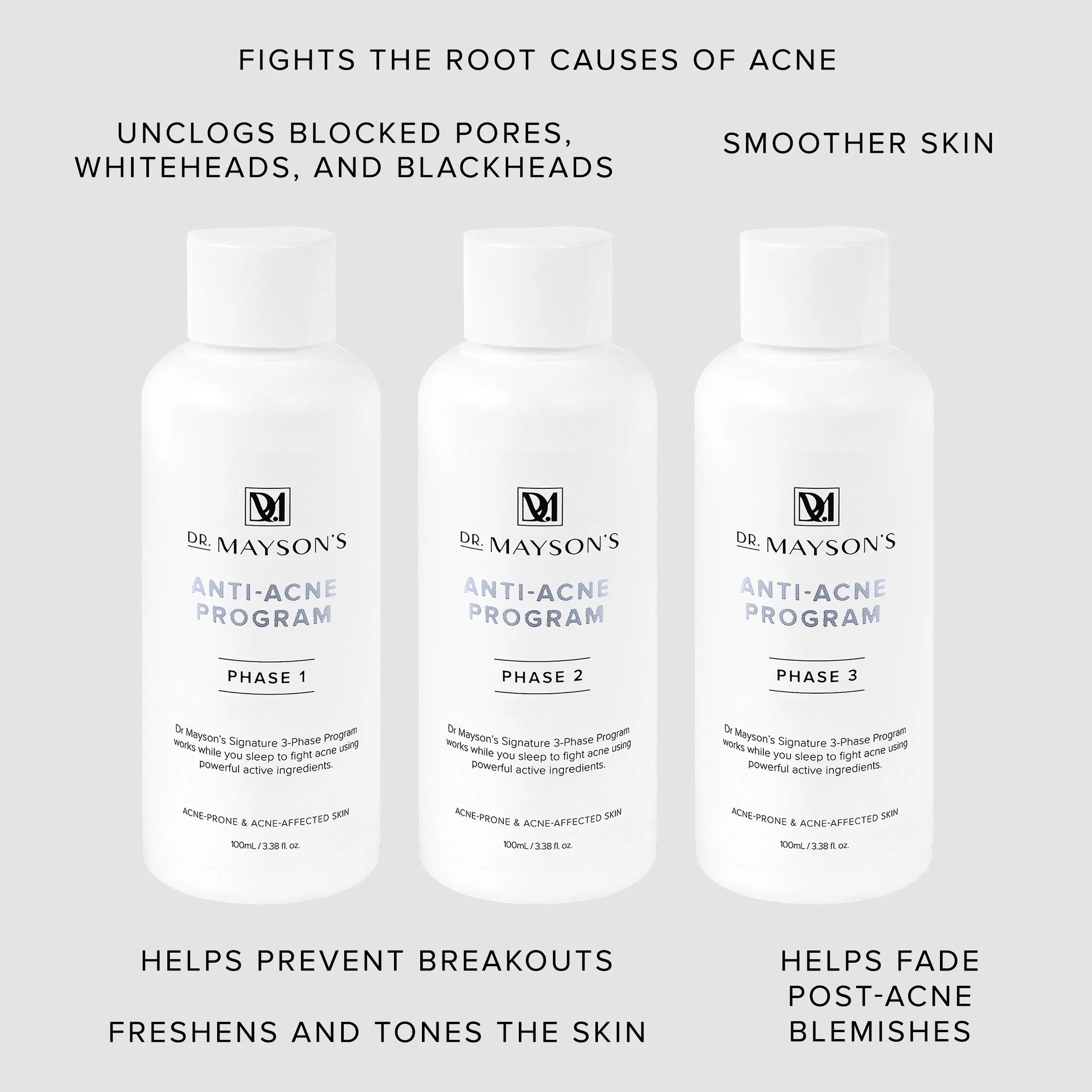 Anti-Acne Program Dr Mayson's Skincare. drmayson's 3-phase anti-acne program. acne treatment program. clear whiteheads and blackheads. prevent breakouts. fade post-acne blemishes.